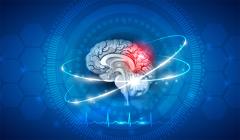 Concussion Concussion
