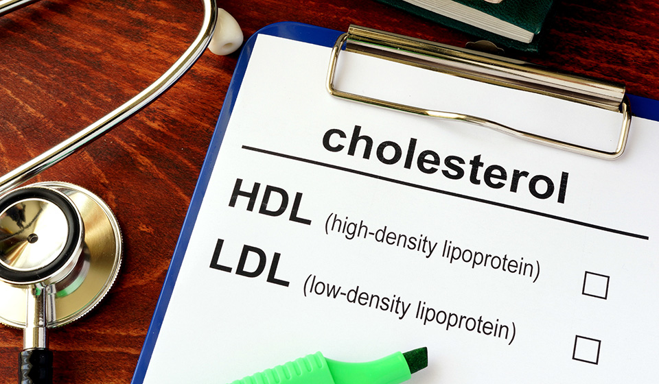 Cholesterol